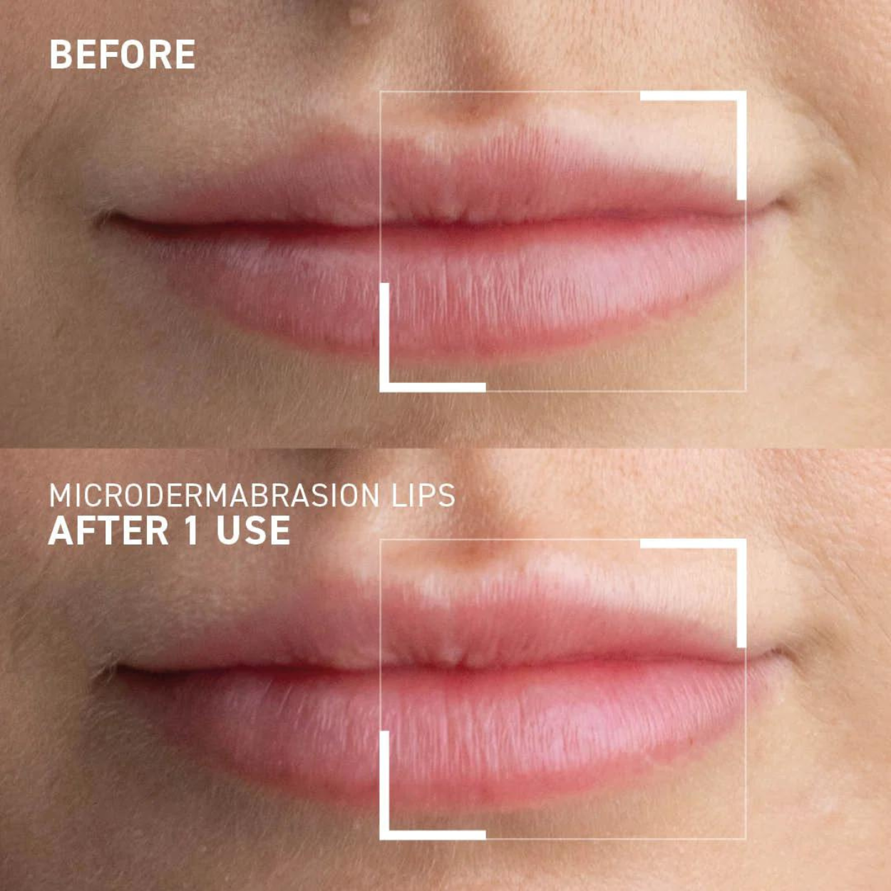 Microdermabrasion Smoothing Lip Scrub