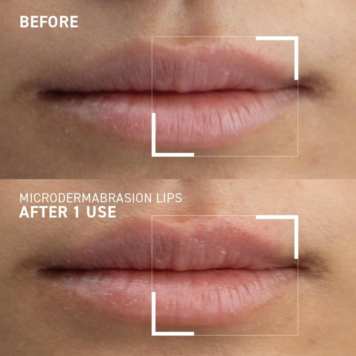 Microdermabrasion Smoothing Lip Scrub