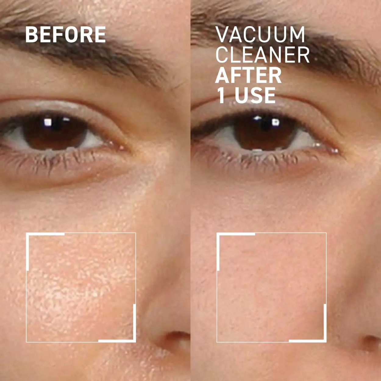 Pore No More - Vacuum Cleaner Pore Purifying Mask (1 oz)